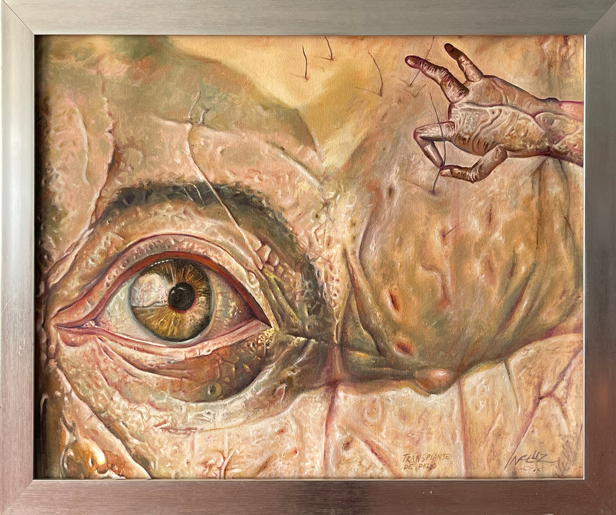 El infeliz – Trasplante de pelo / Óleo sobre Tela – 110 x 80 cm – 1/1